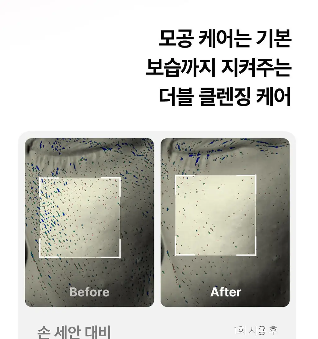 [3D진동클렌징/모공케어] 메디큐브 에이지알 부스터 진동 클렌저 헤드 (베이지/핑크) 상세페이지 30